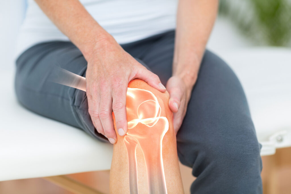 Flourish: Do you have arthritis?